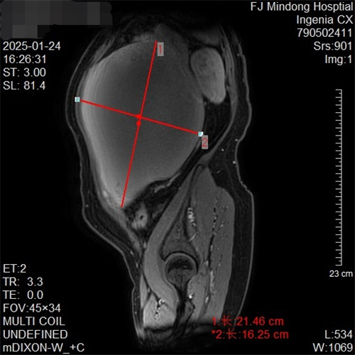 盆腔MRI.jpg